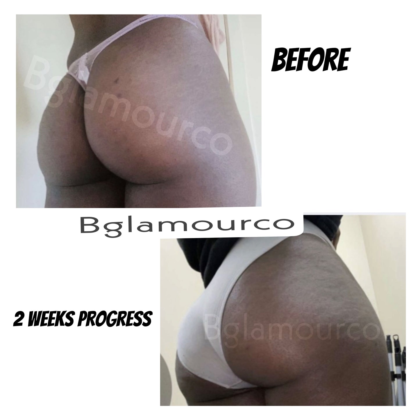 Bglamourco Butt & Hips enlargement oil (for a bigger butt and hips, natural bbl look)