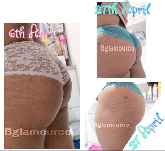 Bglamourco Butt & Hips enlargement oil (for a bigger butt and hips, natural bbl look)